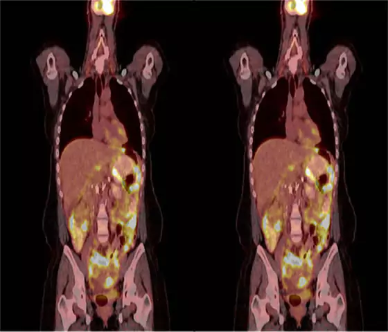clinical trials image