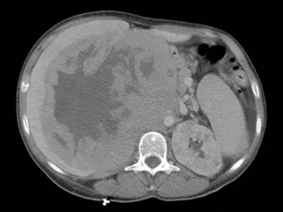 personalized medicine image